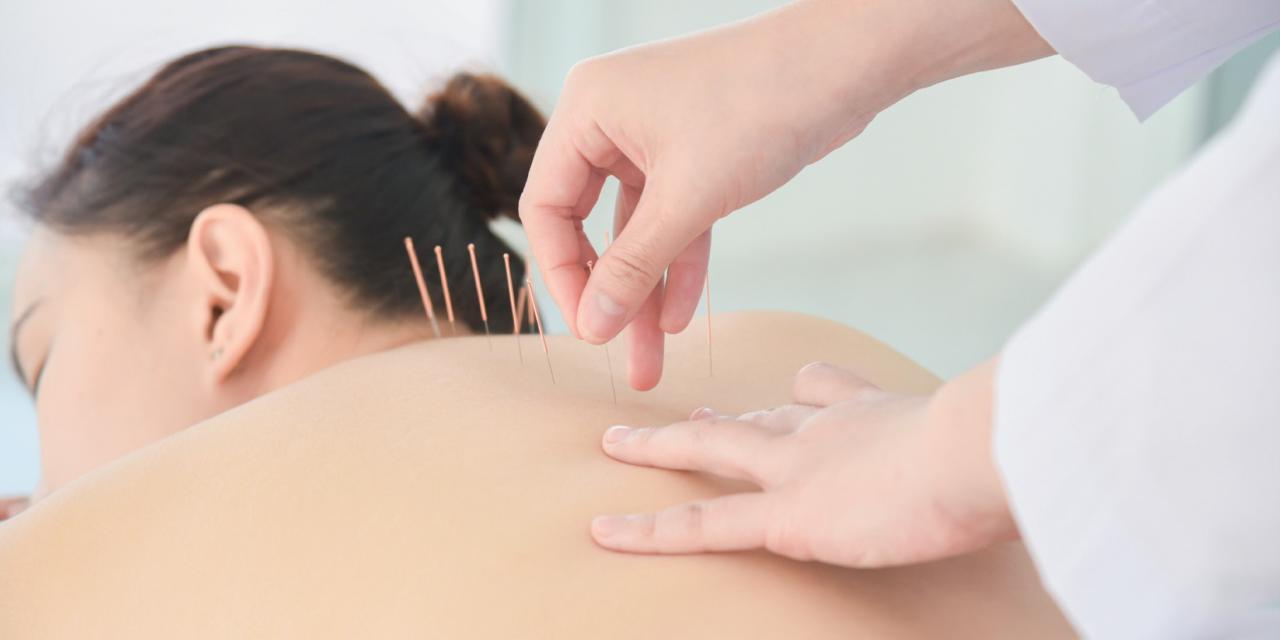 Pic et pic & colégram : l’acupuncture, vous connaissez ?
